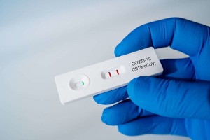 MZd: Epidemiologicky významné kontakty v rámci jedné domácnosti budou nově indikovány k PCR testu
